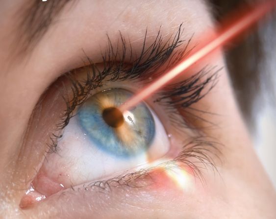 Is Laser Eye Surgery Right for You: Pros and Cons